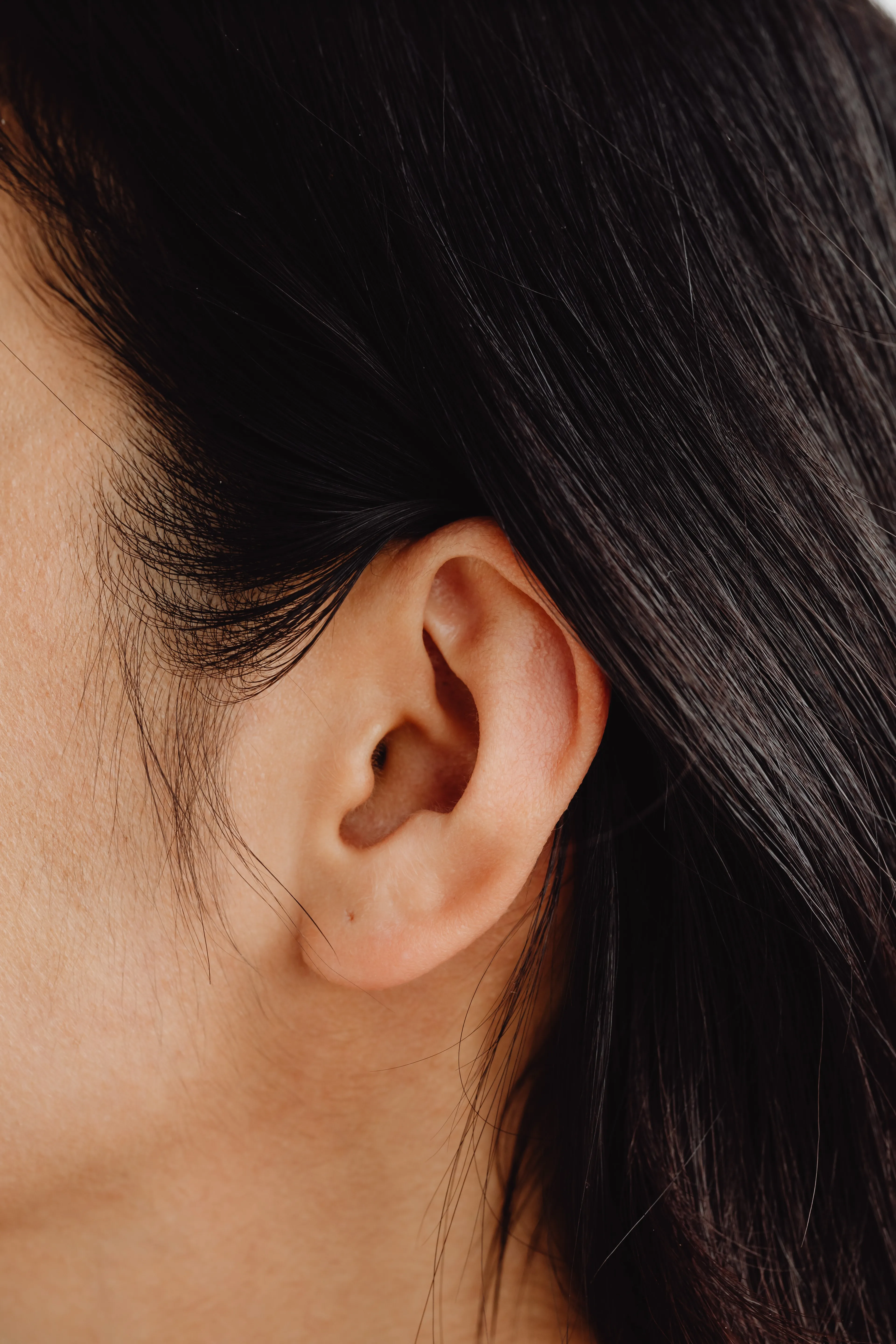 Unveiling the Beauty: Transforming Prominent Ears through Otoplasty